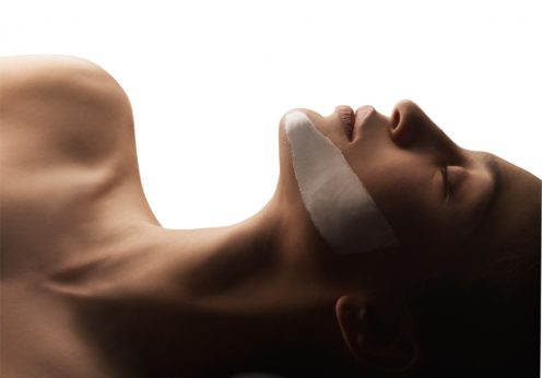 depilacja-laserowa-lodz-3